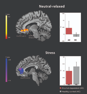 brain signals aud stress